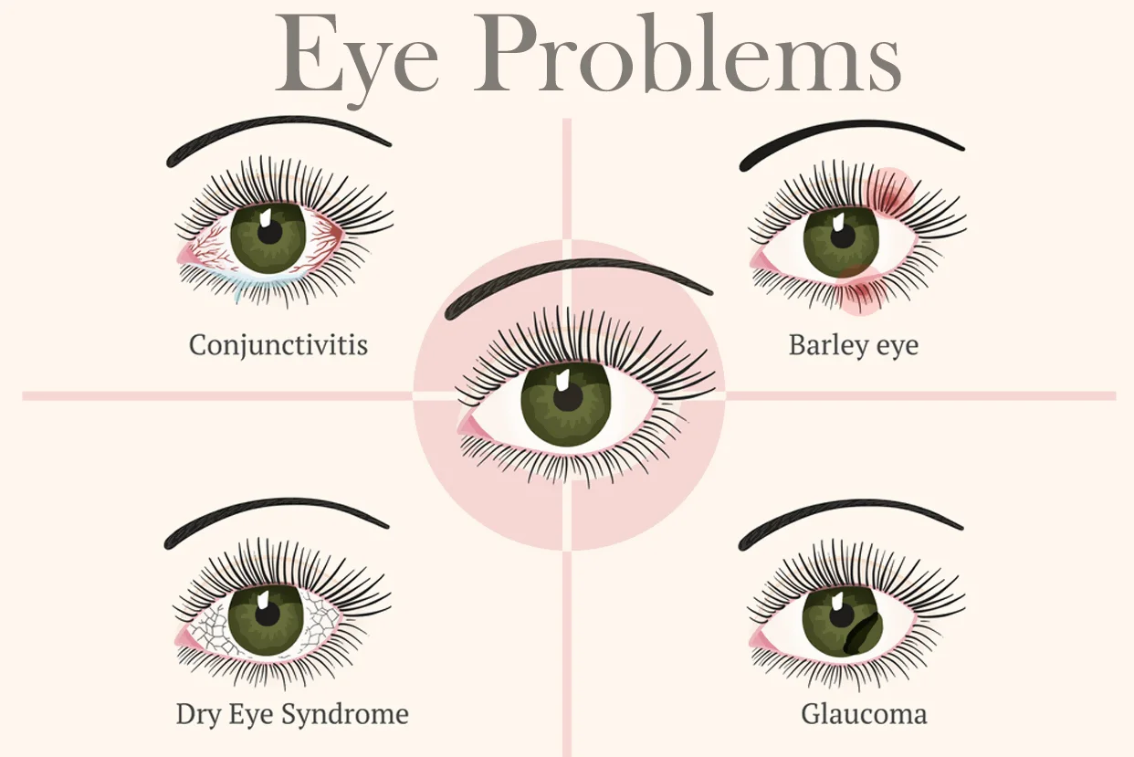 Eye Problems