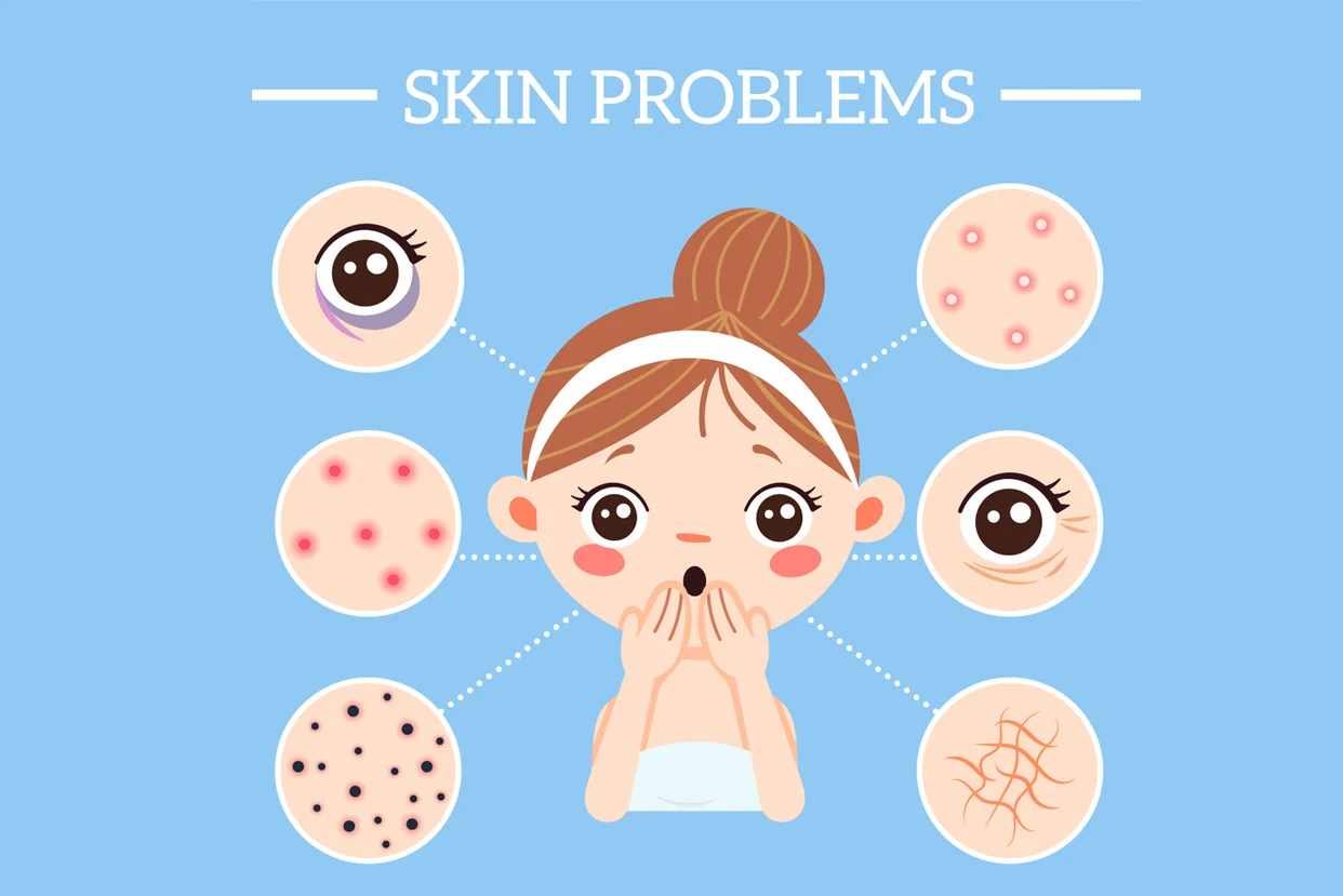 Skin Problems